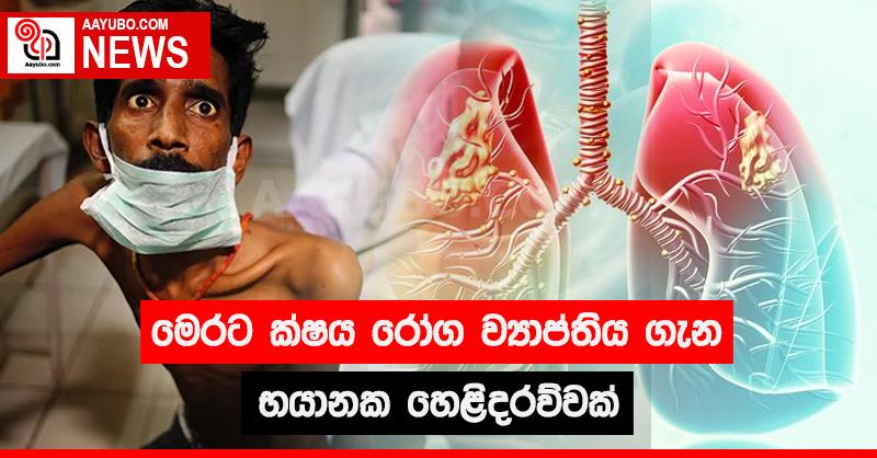 මෙරට ක්ෂය රෝග ව්‍යාප්තිය ගැන භයානක හෙළිදරව්වක්