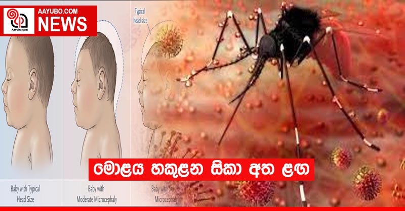 මොළය හකුලන සිකා වෛරසය අත ළගම