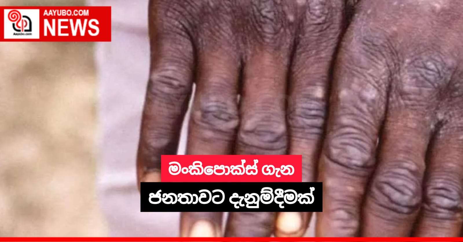 මංකිපොක්ස් ගැන ජනතාවට දැනුම්දීමක්