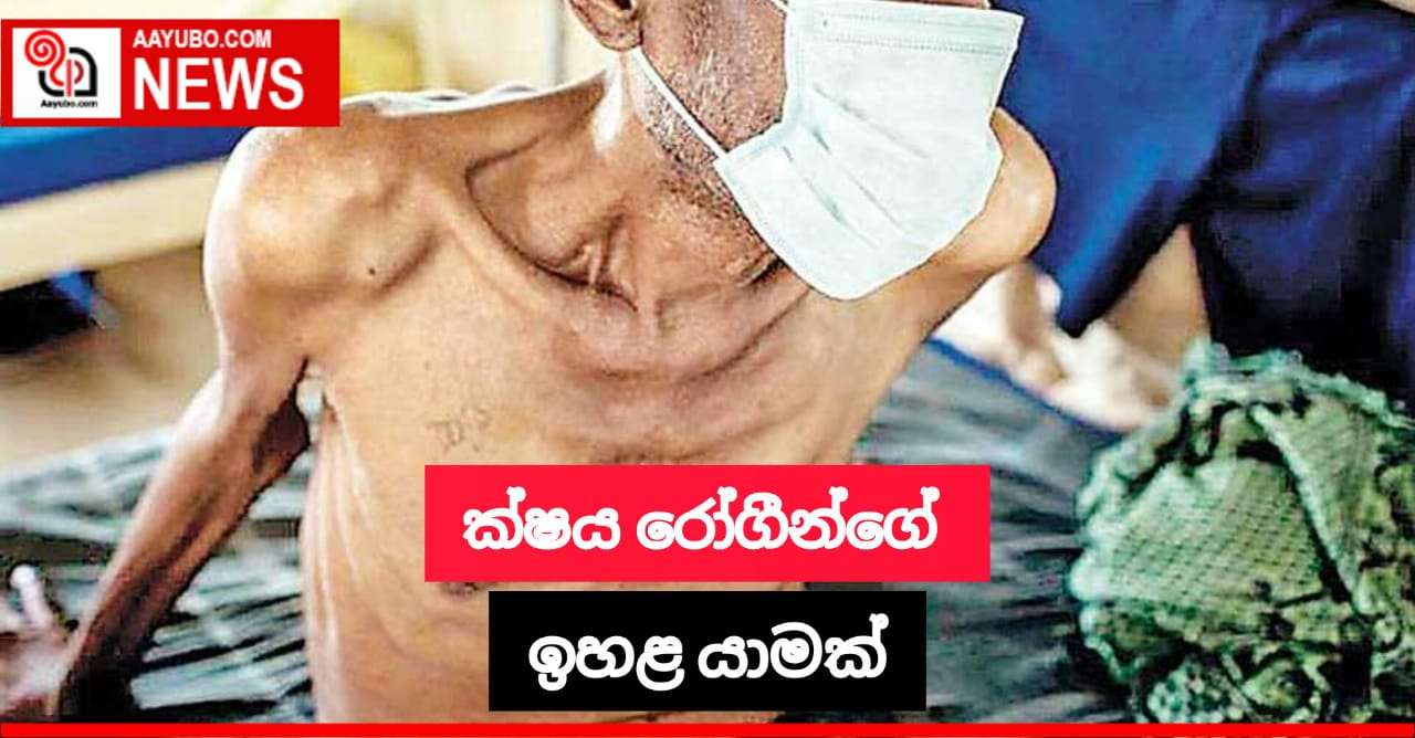 මෙරට ක්ෂය රෝගීන් වාර්තාවීම ඉහළ  යයි