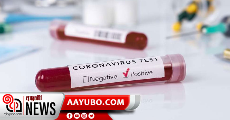 තවත් 57 දෙනෙකුගේ කොරෝනා පොකුරක් කන්දකාඩු වලින් මතුවෙයි 
