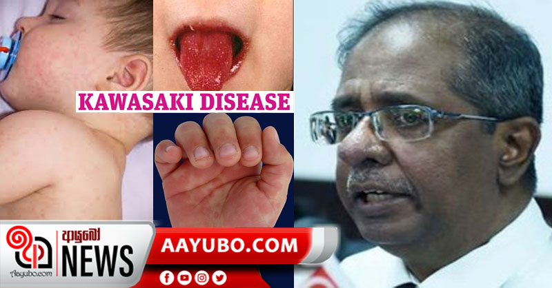 කොරෝනා වැළඳුනු රෝගීන්ට කවසකි රෝගය වැළඳීමේ හැකියාවක්
