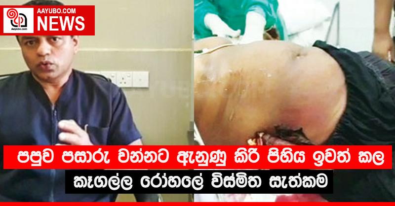 පපුව පසාරු වන්නට ඇනුණු කිරි පිහිය ඉවත් කල කෑගල්ල රෝහලේ විස්මිත සැත්කම