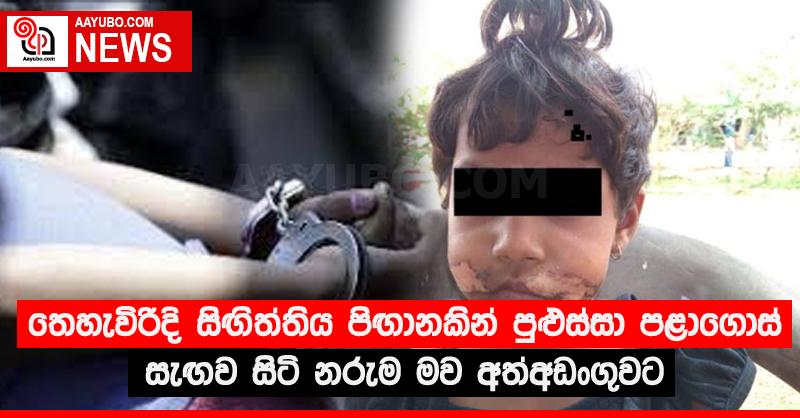 තෙහැවිරිදි සිඟිත්තිය පිඟානකින් පුළුස්සා පළාගොස් සැඟව සිටි නරුම මව අත්අඩංගුවට
