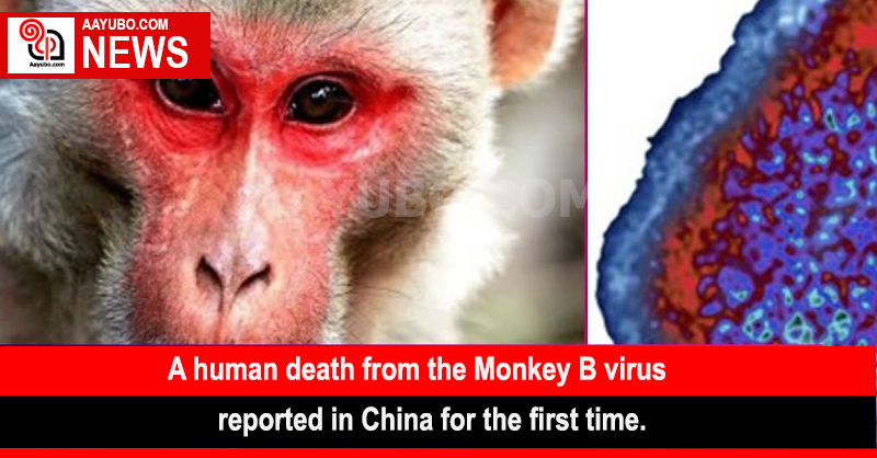 A human death from the Monkey B virus ,reported in China for the first time.