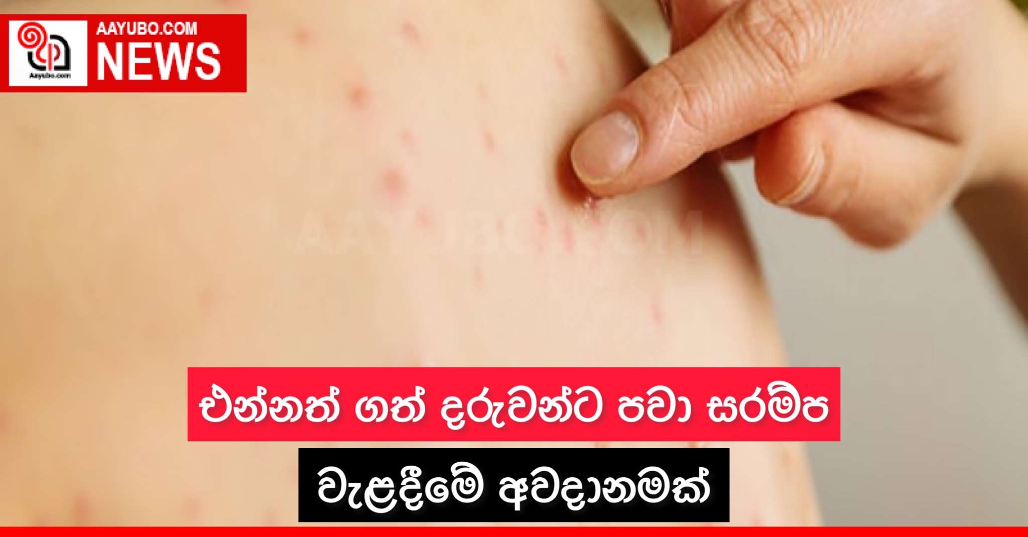 එන්නත් ගත් දරුවන්ට පවා සරම්ප වැළඳීමේ අවදානමක්