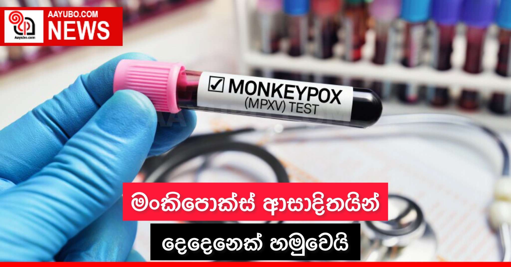 මංකිපොක්ස් ආසාදිතයින් දෙදෙනෙකු හමුවෙයි