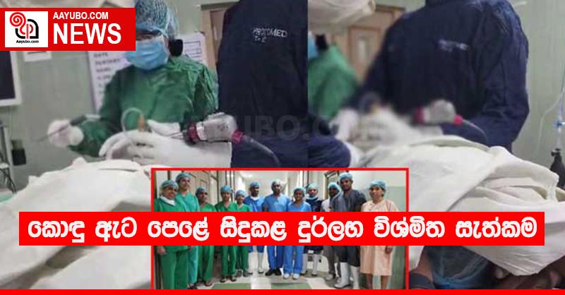 කොඳු ඇට පෙළේ සිදුකළ දුර්ලභ විශ්මිත සැත්කම