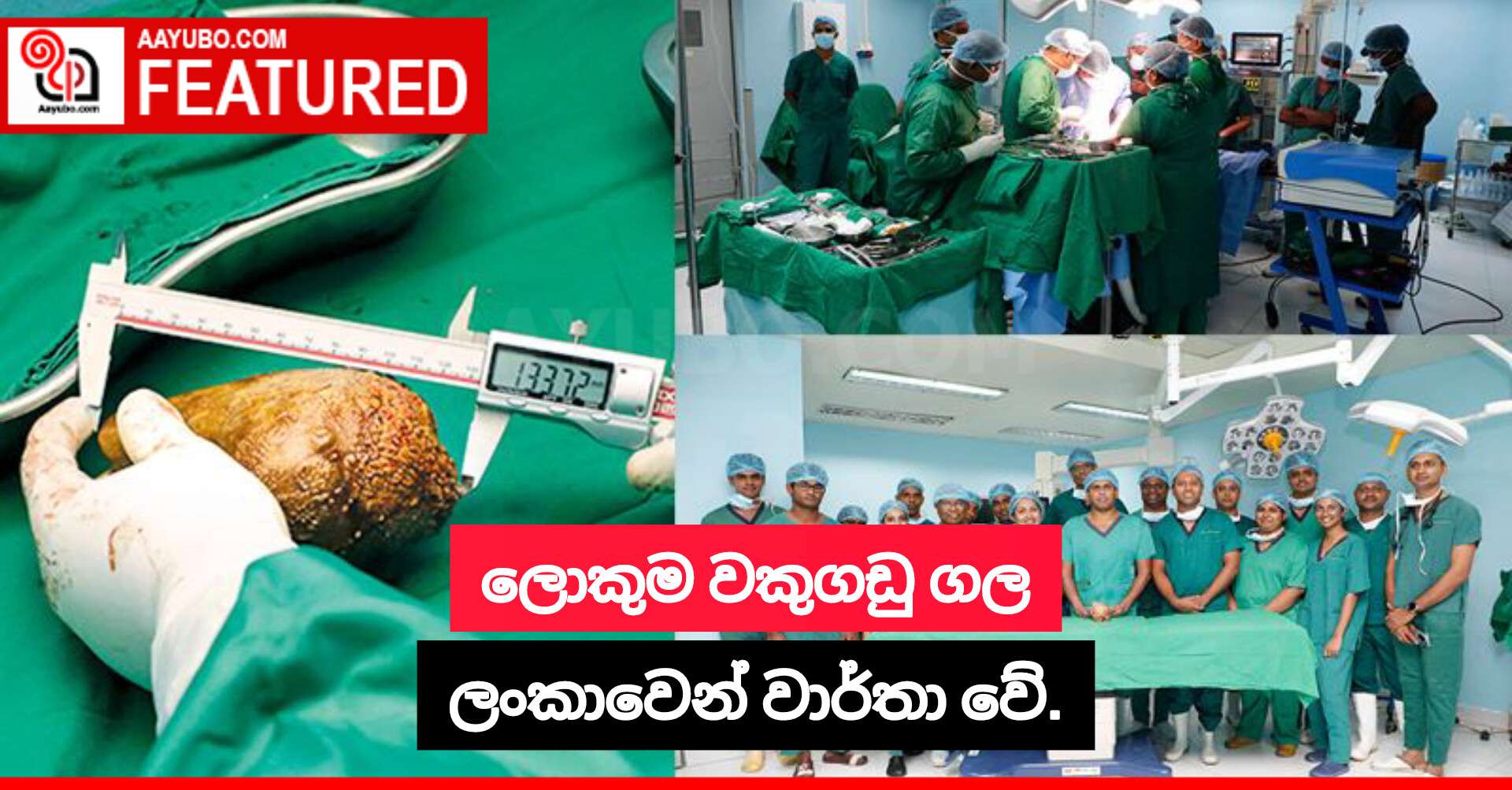 ලොකුම වකුගඩු ගල ලංකාවෙන් වාර්තා වේ.