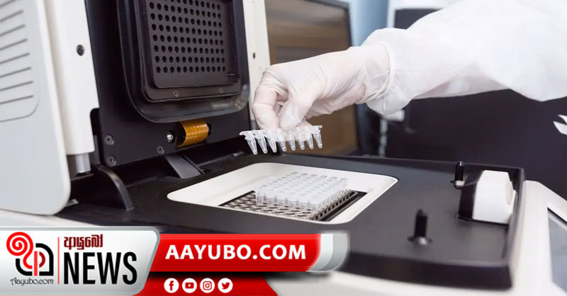 ශ්‍රී ලංකාවේ සමස්ත PCR පරීක්ෂණ ලක්ෂ 08 ඉක්මවයි
