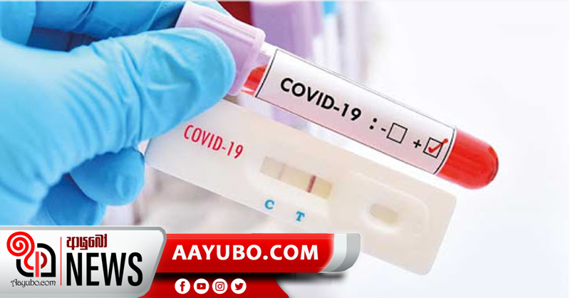 රැපිඩ් ඇන්ටිජන් පරීක්ෂණය රජයේ රෝහල් වලින් පමණයි