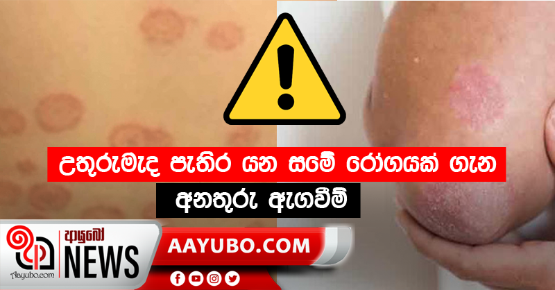 උතුරුමැද පැතිර යන සමේ රෝගයක් ගැන අනතුරු ඇගවීම්
