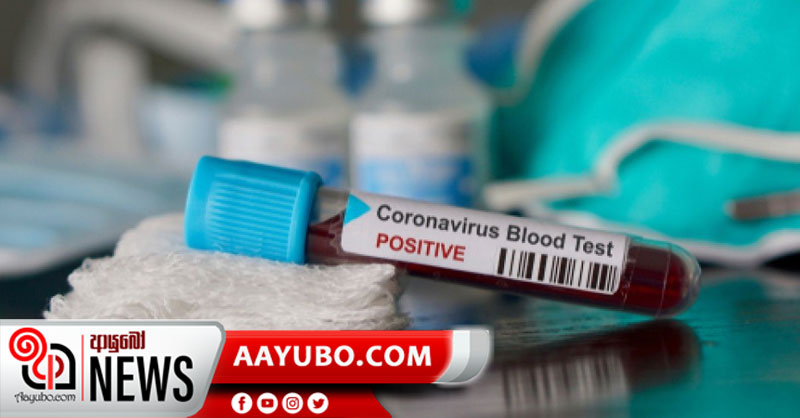 කොරෝනා රෝගීන් ගණන 129ට නගියි 