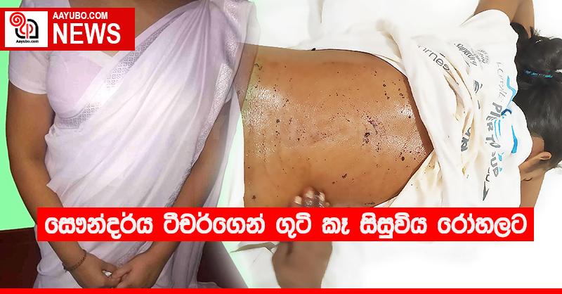 සෞන්දර්ය ටීචර්ගෙන් ගුටි කෑ සිසුවිය රෝහලට