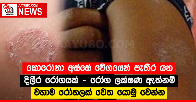 කොරෝනා අස්සේ වේගයෙන් පැතිර යන දිලීර රෝගයක් - රෝග ලක්ෂණ ඇත්නම් වහාම රෝහලක් වෙත යොමු වෙන්න 