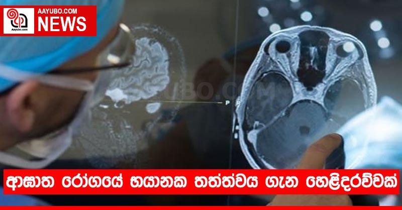 ආඝාත රෝගයේ භයානක තත්ත්වය ගැන හෙළිදරව්වක්