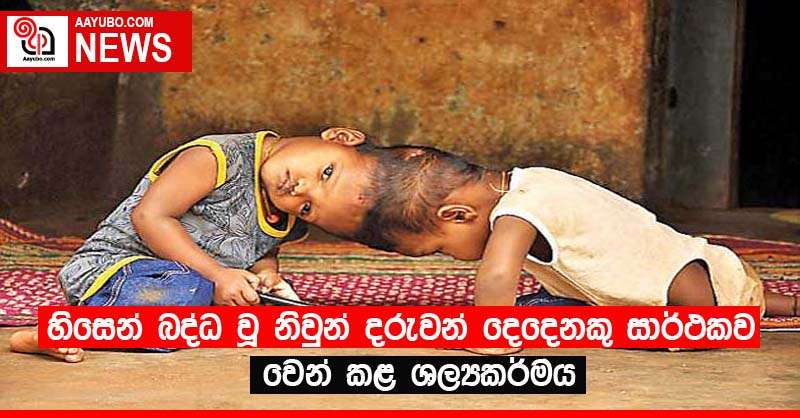 හිසෙන් බද්ධ වූ නිවුන් දරුවන් දෙදෙනකු සාර්ථකව වෙන් කළ ශල්‍යකර්මය
