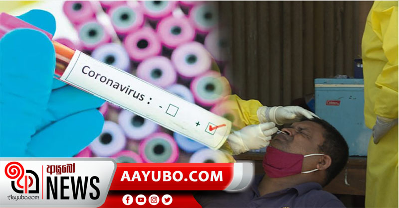 අද නව කොරෝනා ආසාදිතයින් 726 ක්