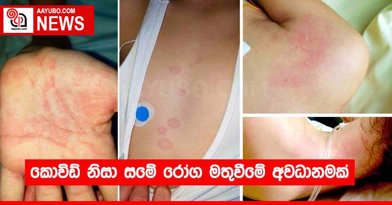 කොවිඩ් නිසා සමේ රෝග මතුවීමේ අවධානමක්