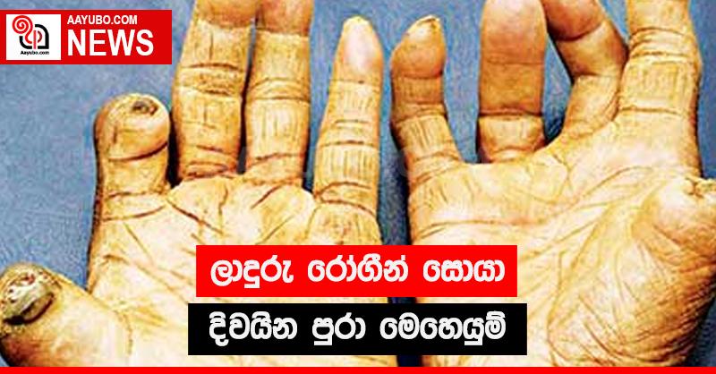 ලාදුරු රෝගීන් සොයා දිවයින පුරා මෙහෙයුම්