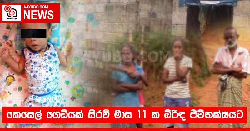 කෙසෙල් ගෙඩියක් සිරවී මාස 11 ක බිලිඳා ජීවිතක්ෂයට