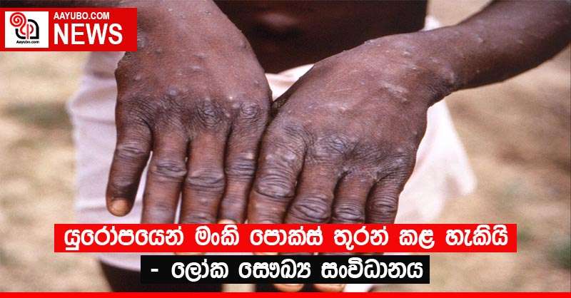 යුරෝපයෙන් මංකි පොක්ස් තුරන් කළ හැකියි - ලෝක සෞඛ්‍ය සංවිධානය