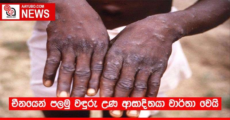 චීනයෙන් පලමු වඳුරු උණ ආසාදිතයා වාර්තා වෙයි
