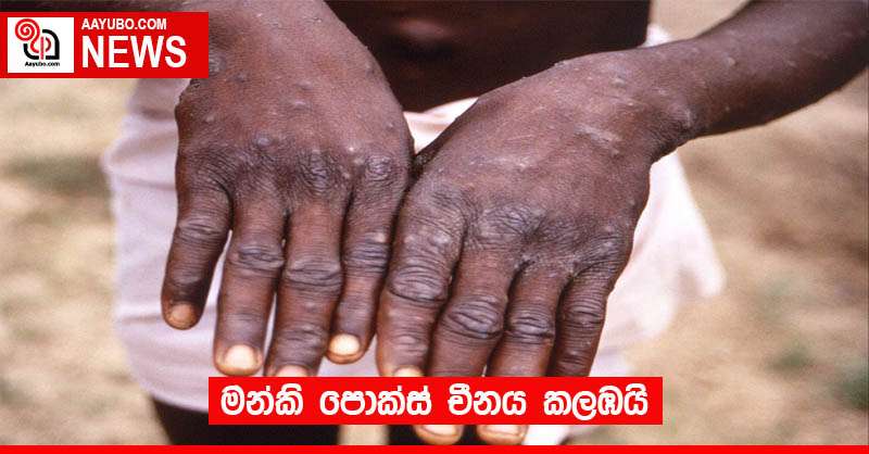මන්කි පොක්ස් චීනය කලඹයි