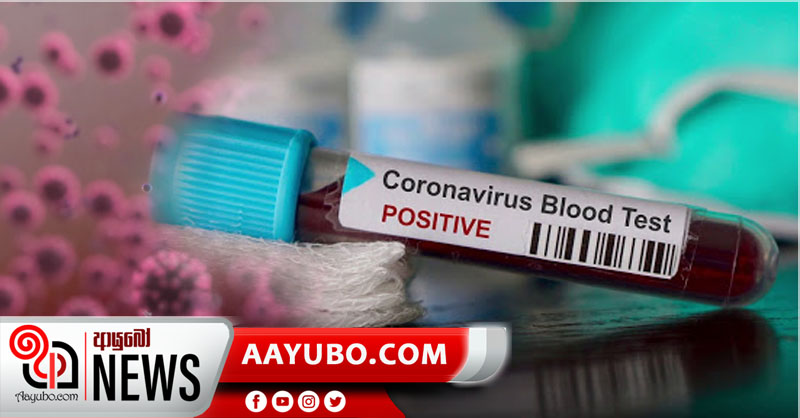 තවත් 361ක් - ආසාදිතයින් ගණන 65,000 පනී