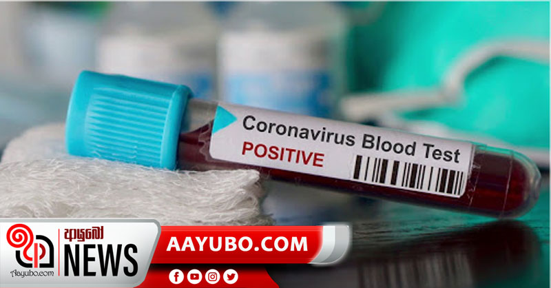 මෙරටින් තවත් කොරෝනා ආසාදිතයින් 297ක් හමුවෙයි