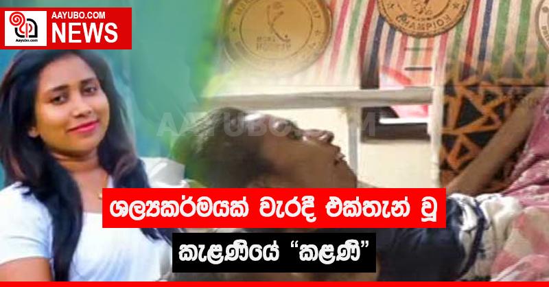 ශල්‍යකර්මයක් වැරදී එක්තැන් වූ කැළණියේ "කළණි"
