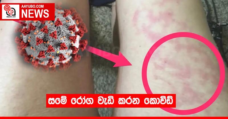 සමේ රෝග වැඩි කරන කොවිඩ්