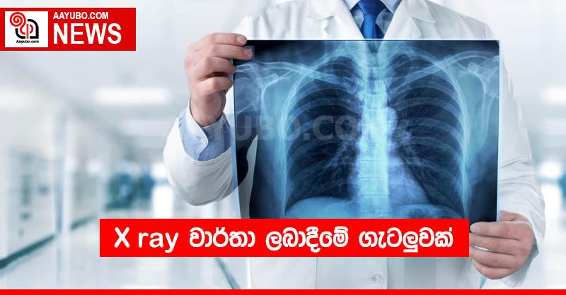 X ray වාර්තා ලබාදීමේ ගැටලුවක්