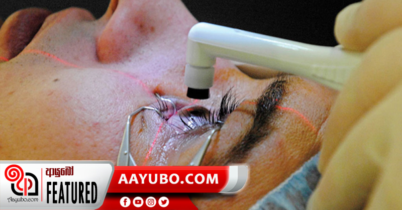 ඇසේ සුද ඉවත් කරන සැත්කම්