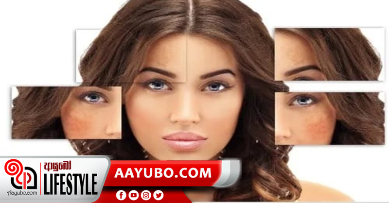 කාන්තාවන්ට හිසරදයක් වී ඇති පිග්මන්ටේෂන්