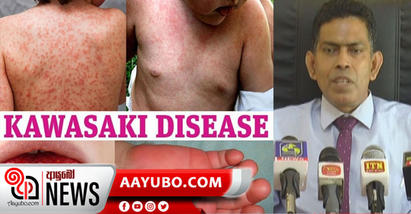 කවසකි රාේගී දරුවන් ශ්‍රී ලංකාවේත් හමුවෙයි