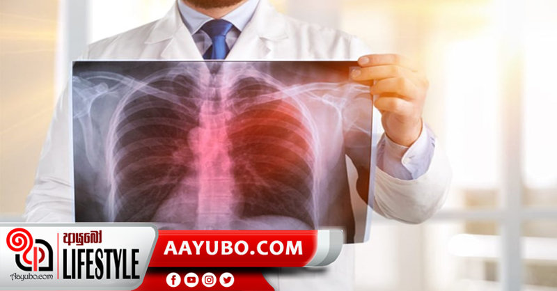 මරුට අත වනන පෙනහළු පිළිකා